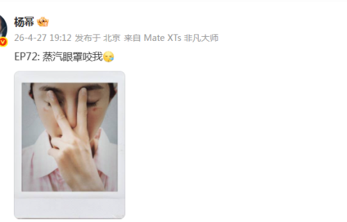 杨幂晒照彰显敬业精神，眼角伤痕引人心疼，精湛演技受期待