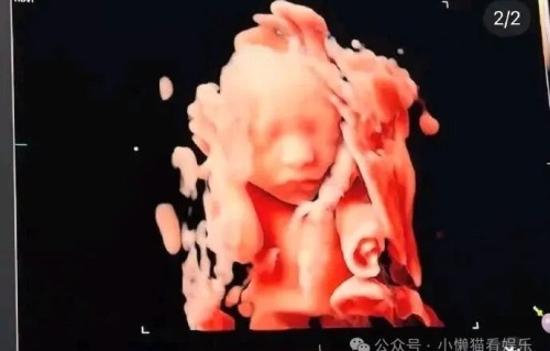 前FTISLAND宋承炫官宣怀孕!晒B超照迎“小太阳”,结婚1年多甜度超标