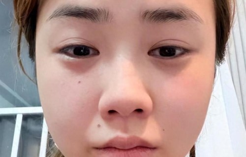 钱再多有什么用！千万网红董赤赤断更5个月后，再出现时面相大变