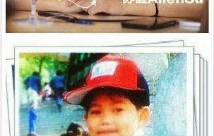 还有哪些明星也坦然面对并自信展示过自己独特的身体特征或胎记？|苏醒|李嫣|王菲|吴尊|刘德华