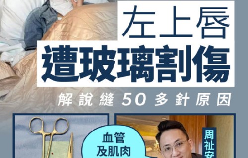 卫诗雅嘴唇受伤缝了50多针会影响拍戏吗？